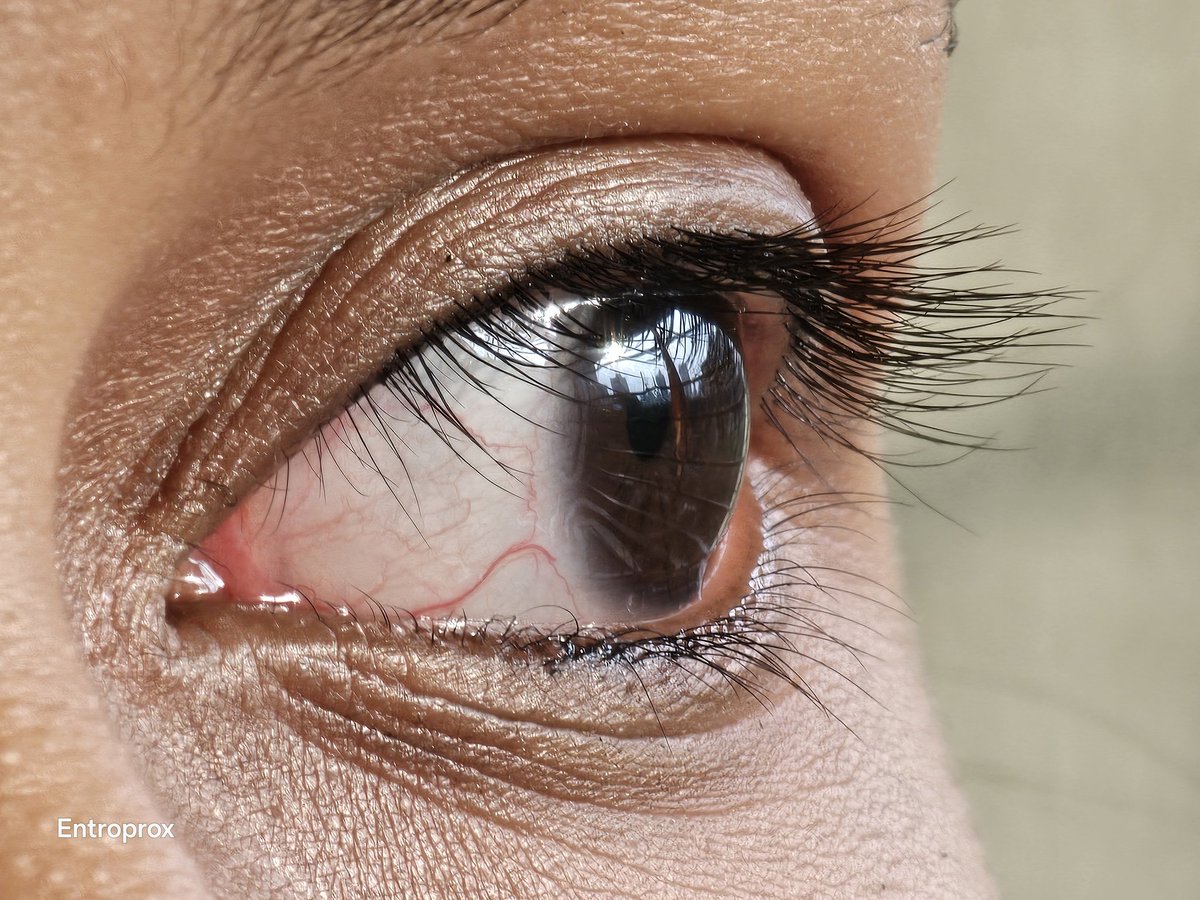 Entroprox's tweet image. Galaxy S23 Ultra Macro shot 📸

A or B?