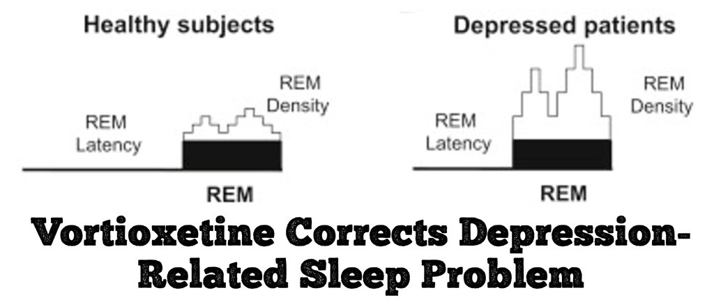 Vortioxetine (Trintellix) corrected depression-related #sleep changes (REM latency) in before-after trial of 30 teens
ncbi.nlm.nih.gov/pmc/articles/P…
Hard to tell if this is due to the med or recovery from #depression. Bupropion &amp; psychotherapy accomplished similar things.

#psychiatry