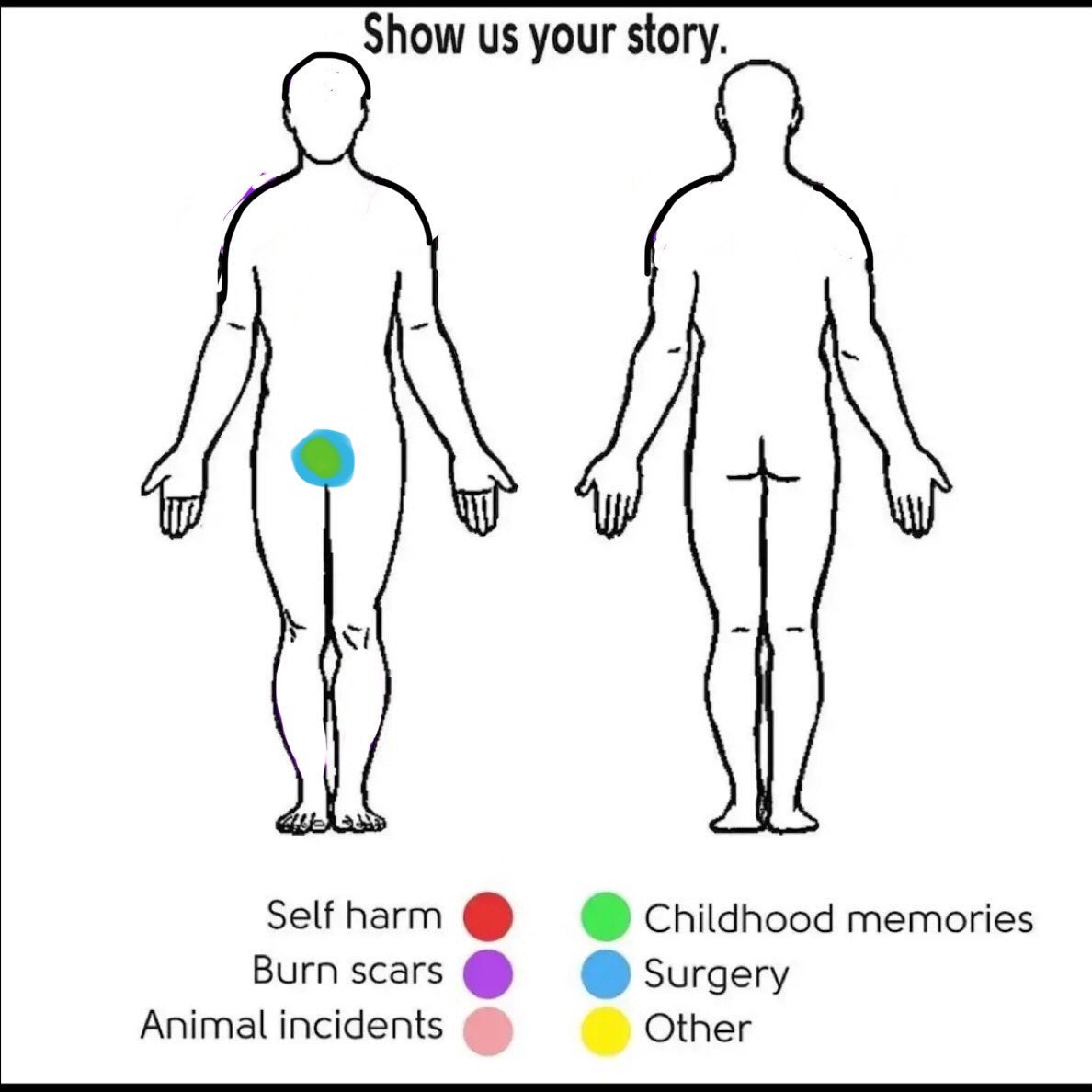 audiplj's tweet photo. Sunat (childhood memories + surgery) https://t.co/zkRzuEopYy
