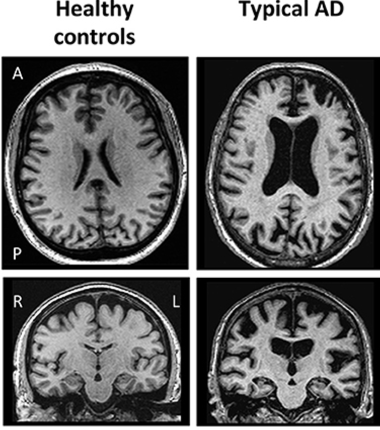 Outdoctrination's tweet image. Getting old sucks. Especially for your brain.

Here are 6 tools to help keep you sharp, your brain young and cognitive decline away: