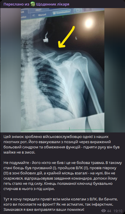 PlombirVkusniy's tweet photo. автора канала знаю лично
врач гинеколог. выехал с оккупации, прошел такмед, он на фронте,а не в барбершопе
 не думаю что он врет 

но для подоляка и его ботов - это раисянское ипсо https://t.co/e4dCKQY1yb