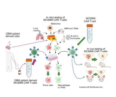 Mayo Clinic Transplant (@mayotransplant) on Twitter photo This study's findings establish MC9999 as a foundation for the development of effective CAR T cell therapies against solid tumors. #CARTTherapy <a href="/DoctorQMd/">Dr. Alfredo QuiƱones-Hinojosa</a> <a href="/hd_DongMDPhD/">Haidong Dong</a> <a href="/MKD_BMT/">Mohamed Kharfan-Dabaja, MD, MBA</a> <a href="/RDroncaDr/">Roxana Dronca, M.D.</a> <a href="/DrYanyanLou/">Dr. Yanyan Lou</a> <a href="/aotamendi_md/">Andrea Otamendi-Lopez, M.D.</a> <a href="/MolTherapy/">Molecular Therapy</a>
bit.ly/4irzKLo This study's findings establish MC9999 as a foundation for the development of effective CAR T cell therapies against solid tumors. #CARTTherapy <a href="/DoctorQMd/">Dr. Alfredo QuiƱones-Hinojosa</a> <a href="/hd_DongMDPhD/">Haidong Dong</a> <a href="/MKD_BMT/">Mohamed Kharfan-Dabaja, MD, MBA</a> <a href="/RDroncaDr/">Roxana Dronca, M.D.</a> <a href="/DrYanyanLou/">Dr. Yanyan Lou</a> <a href="/aotamendi_md/">Andrea Otamendi-Lopez, M.D.</a> <a href="/MolTherapy/">Molecular Therapy</a>
bit.ly/4irzKLo