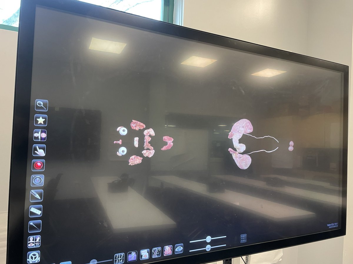 MrsTobyKlein's tweet image. Learn and Lunch to officially end the Nervous System and make connections to our next unit the Endocrine System! @MineolaUFSD @mineolahs #AnatomageTable