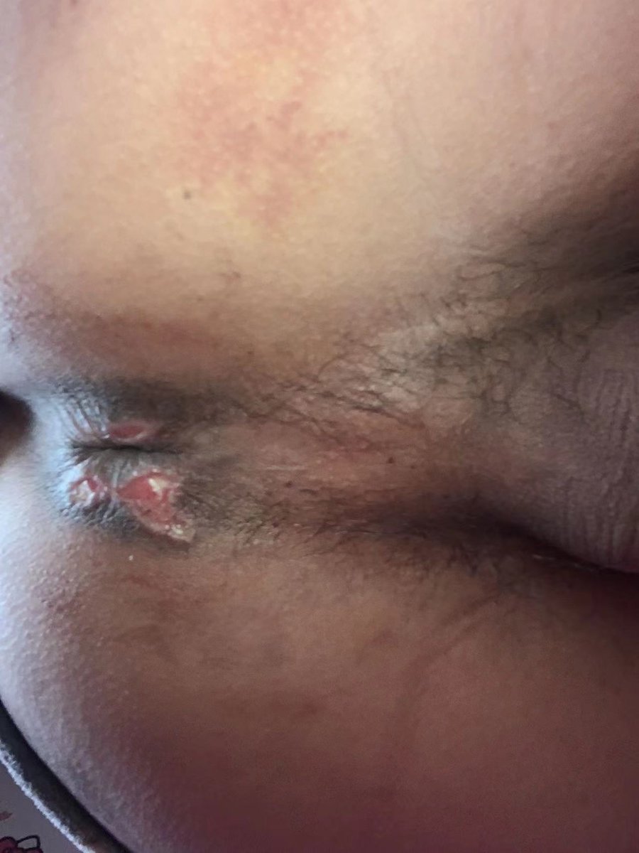 gaysm #烟头烫逼 #烟头 #烟灰缸 #spank #gayspank #mmspank #男男打屁股 
最刺激的一次玩法，烟头烫逼加狠抽屁股，前军主定的标准太高，还是没能达到，你们的主人标准高吗？