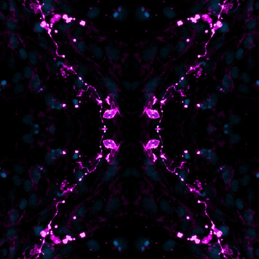 Check out these festive microscopy images submitted to our image competition over the years! 📸  

They have been taken by our researchers as they work to understand rare and complex diseases, bringing us closer to new treatments and cures. 👩‍🔬