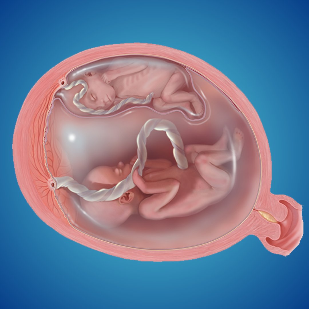 Connecticut Children's tweet media