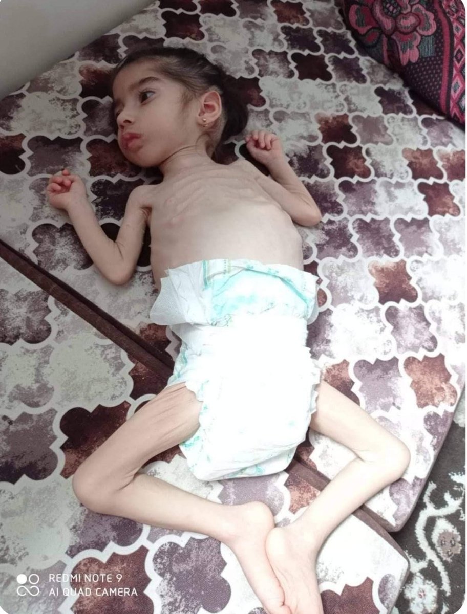 IF YOU SEE THIS ON YOUR TL YOU HAVE TO RT!!!!!  
Firstly, Follow <a href="/Palestinedaily1/">Mohammed's Relief Projects✌️🇵🇸✌️</a>
Rana is at £330. Can we help her get to £1,000 for medical care ?  

‼️Even if you can’t donate, please at least share‼️   

PLEASE DON’T IGNORE THIS
gofund.me/a778cc9f