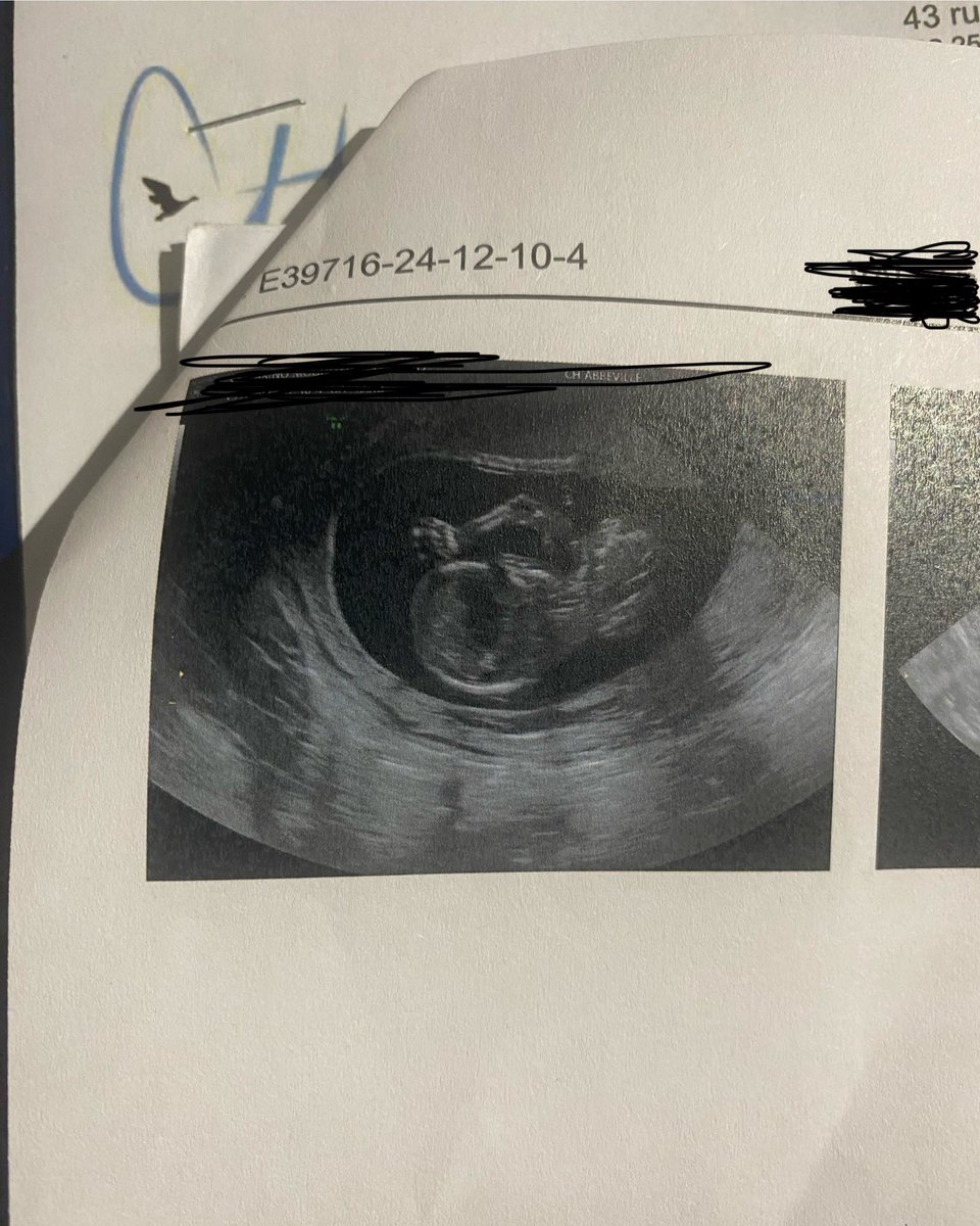 Notre petite équipe va bientôt s'agrandir ! Un bébé est en route et on est déjà fous de joie ! 💖