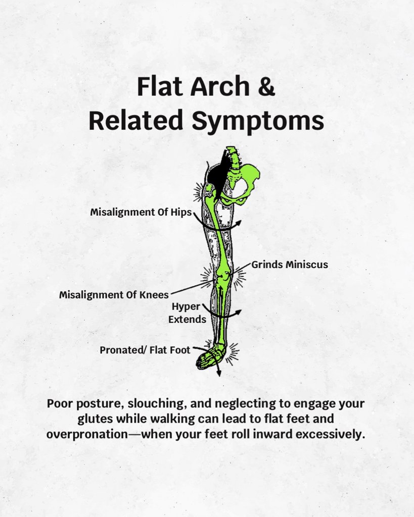 Poor posture, slouching, and neglecting to engage your glutes while walking can lead to flat feet and overpronation-- when your feet roll inward excessively.