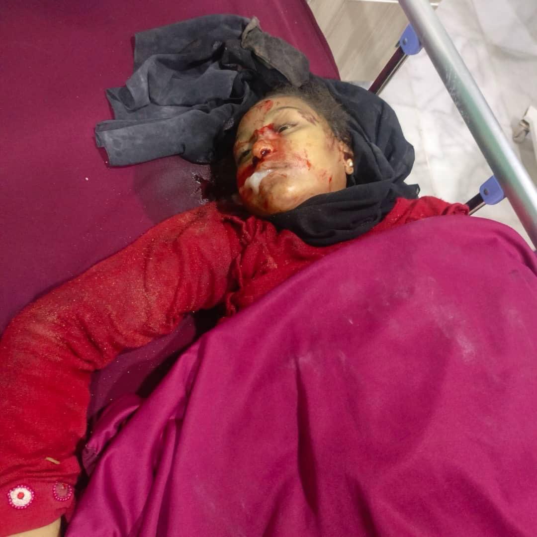 IslamZebari's tweet photo. الاحتلال التركي يرتكب مجزرة جديدة في ريف كوباني شمال سوريا

ارتكب الاحتلال التركي مساء اليوم مجزرة جديدة بحق المدنيين راح ضحيتها مدنيان اثنان إحداهما طفلة، وأصيب طفلان آخران بجروح جراء قصف مدفعي، استهدف قرية جعدة الكبيرة بريف مدينة كوباني شمالي سوريا. https://t.co/3WsxaFgiGs