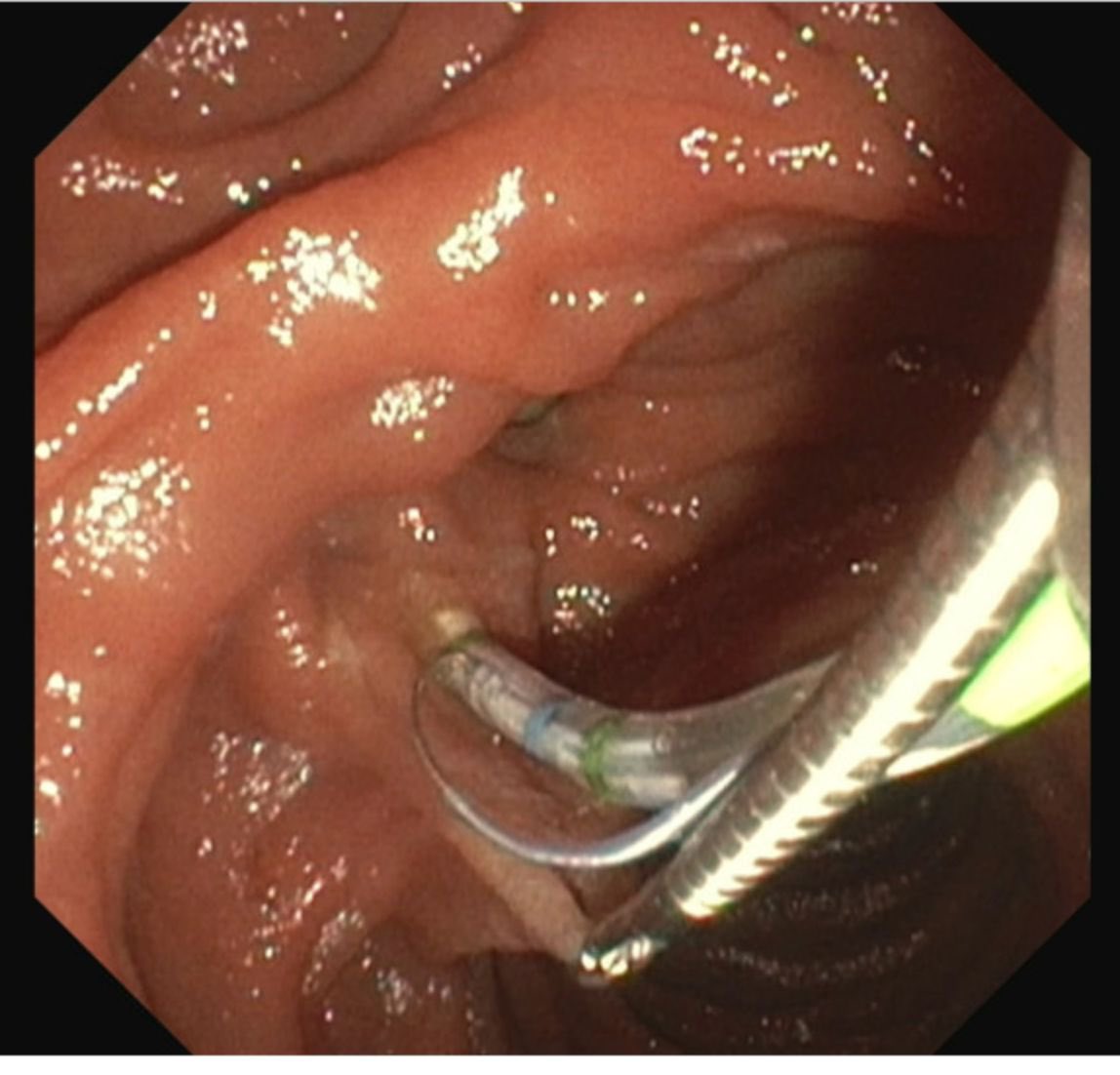 Jean Chalhoub tweet media