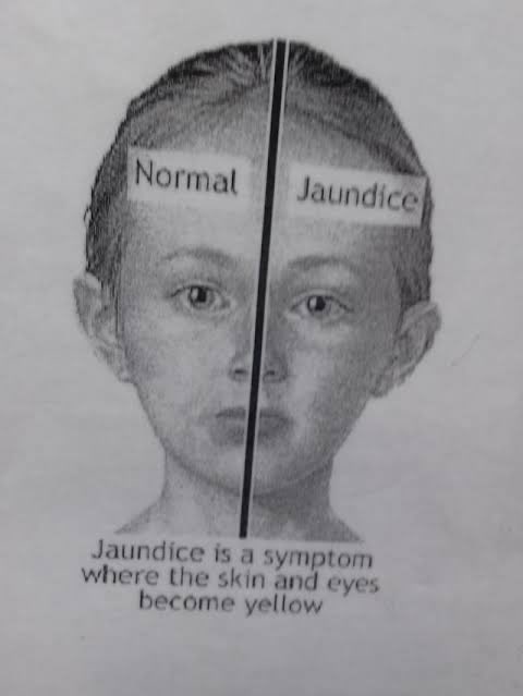 bjproteinRMT's tweet image. ???