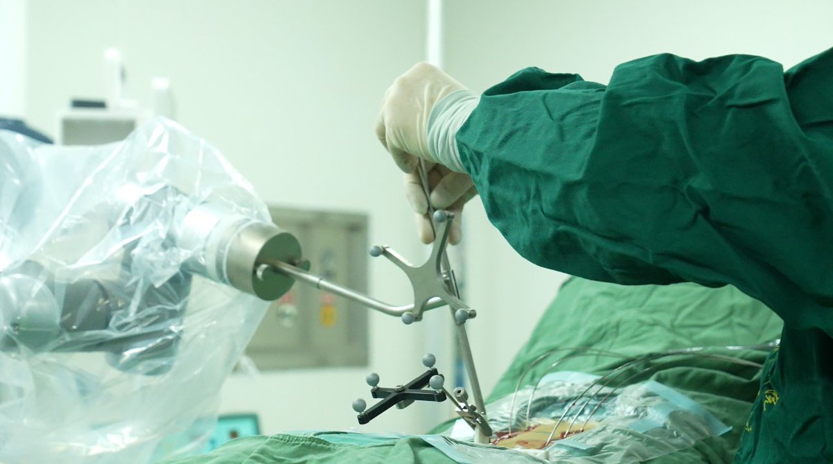 perlove_robot's tweet photo. 💡 Empowering Healthcare with Cutting-Edge Technology
Chongqing Sanxia Medical College Hospital is the first in Wanzhou District to use Perlove Medical’s advanced 3D imaging and orthopedic surgical robots for spine surgery. 🏥🤖 #HealthcareInnovation #RoboticsInMedicine https://t.co/Us5cwe3nq7