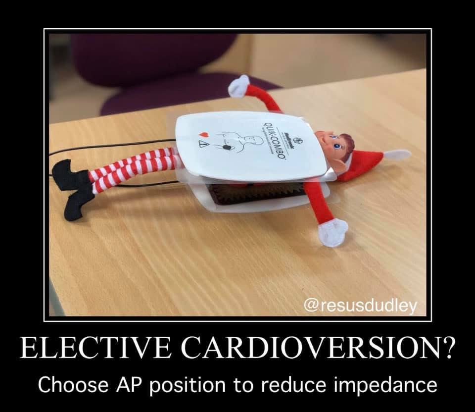 resusdudley's tweet image. Day 11 of our #ResusAdventCalendar demonstrates the best defib pad position for elective DC cardioversion to reduce impedance is AP #DeterioratingPatients #AdventCalendar #Resus