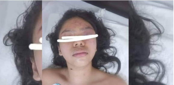 Diariodenarco's tweet photo. La menor terminó la relación en la que sufría violencia pero la niña de 13 años fue acuchillada 15 veces por su ex-novio de 13 años afuera de la secundaria Liceo Emperadores Azteca en Iztapalapa

NOTA EN EL ENLACE: https://t.co/LmttV8mmIg https://t.co/dxaKPNMLvg