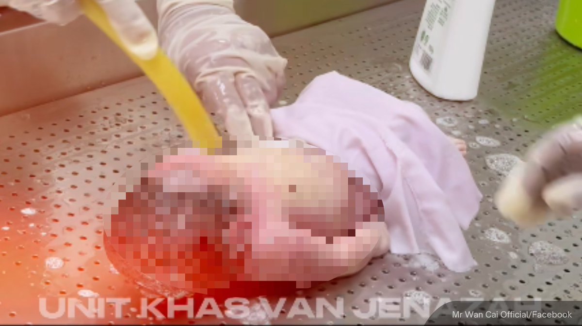 NewsBFM's tweet photo. A private hospital in Petaling Jaya reportedly held the body of a baby for two weeks in a freezer, as his father could not afford to claim the body.

A funeral management service responsible for handling the infant's remains said his body was completely frozen before being thawed for proper handling.

🧵1