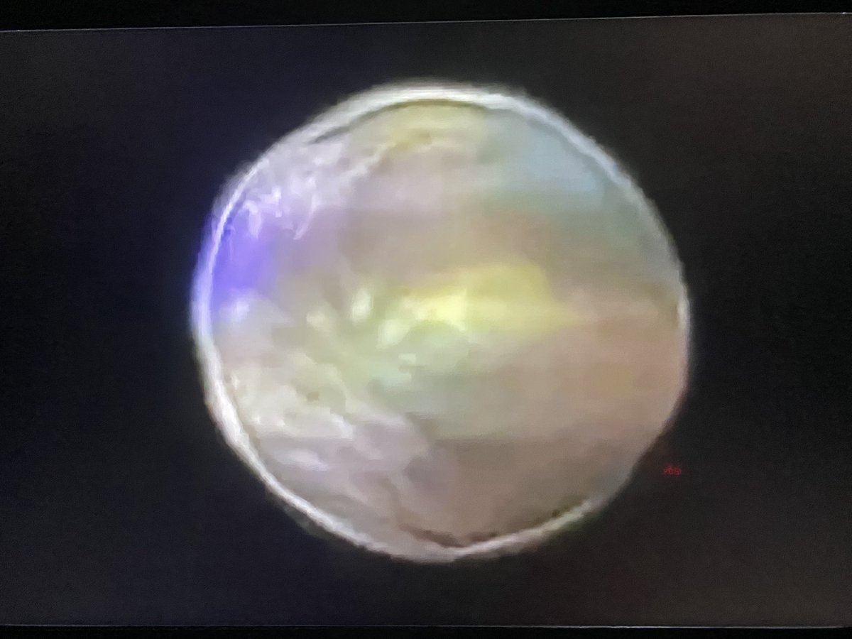 tparon's tweet image. 🚨🇺🇸NEW CRAZY VIDEO MAN FILMING THE UAPs OVER NEW JERSEY WITH HIS TELESCOPE SHOWS SOME OF THE DRONES ARE UAP ORBS.

THEY SEEM TO HAVE SOME KIND OF A FIELD AROUND THE CRAFTS⭕️