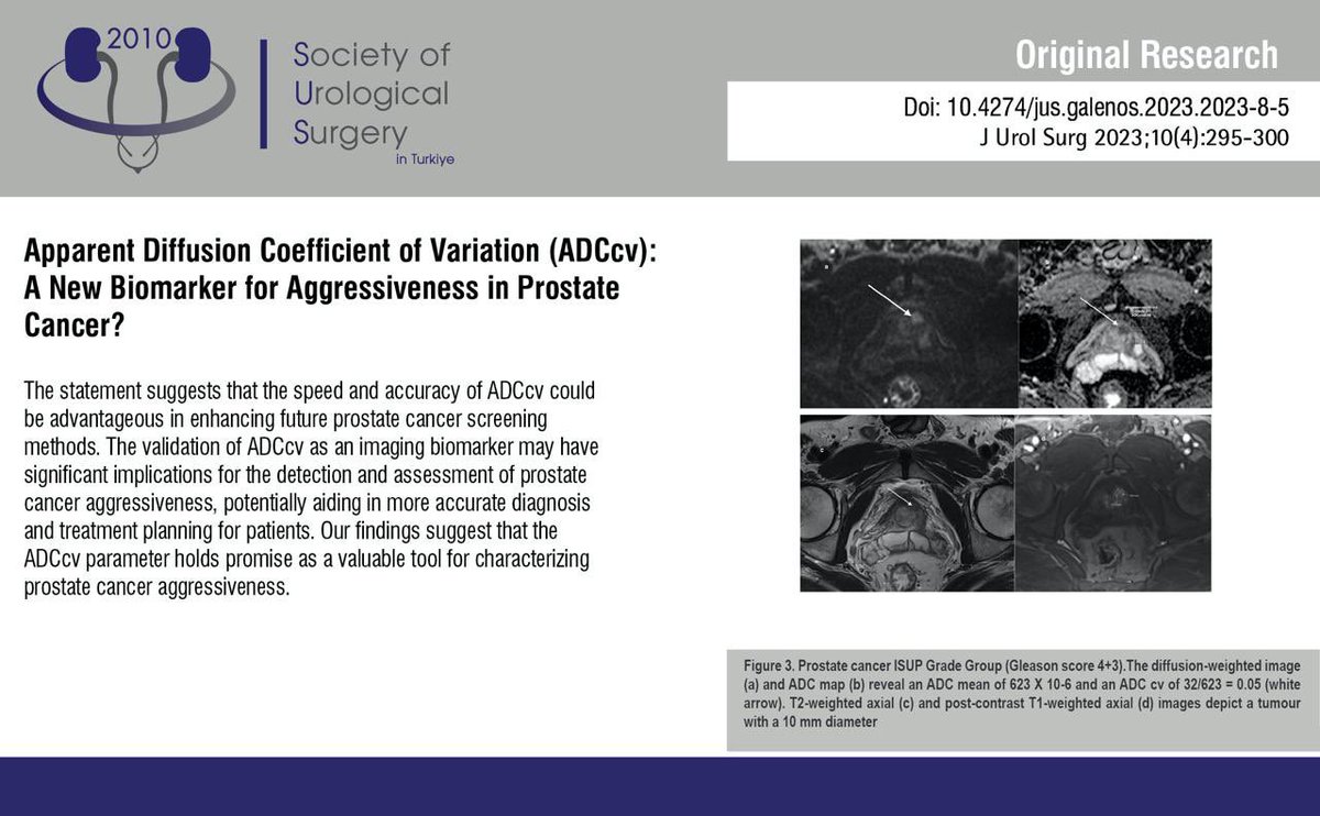 JUsurgery's tweet image. Apparent Diffusion Coefficient of Variation (ADCcv): A New Biomarker for Aggressiveness in Prostate Cancer?
 
You can see the free full text of the research by Aylin Altan Kuş et al.
 
Link : d2v96fxpocvxx.cloudfront.net/new/a426c3a3-a…
 
#Diffusion #weightedimaging #apparent #diffusion #coefficient