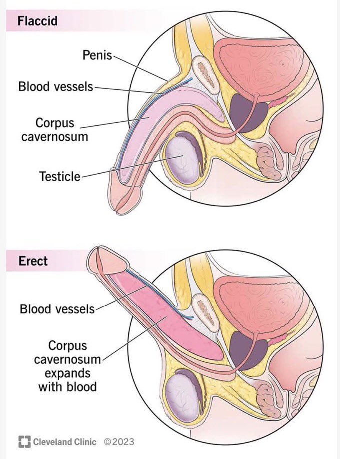 celebritypharm's tweet image. ERECTILE DYSFUNCTION : Why you should speak up 

Are You Feeling shy about Erectile Dysfunction? 

It might be making things worse! 😬

Let’s learn about this condition 

Come with me 👇