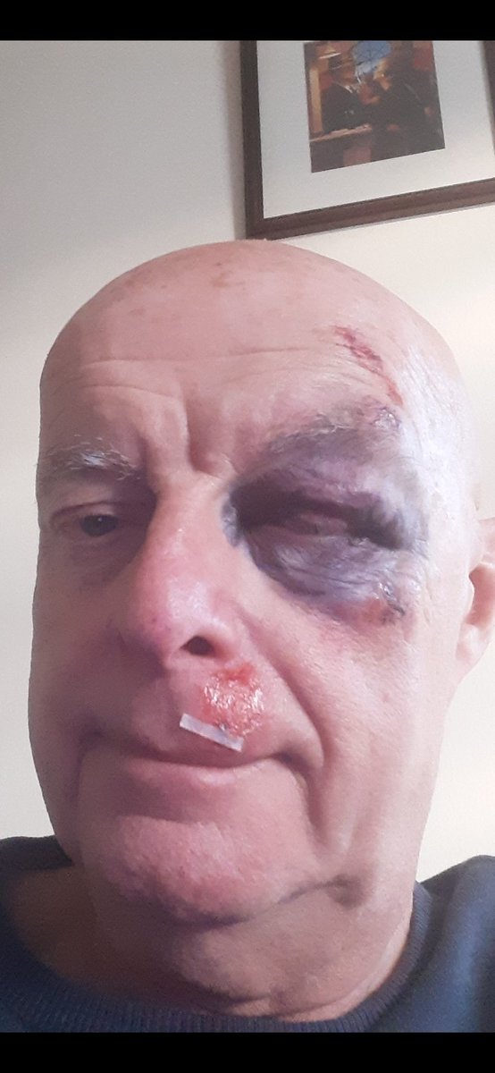 Alexander Bisset tweet media