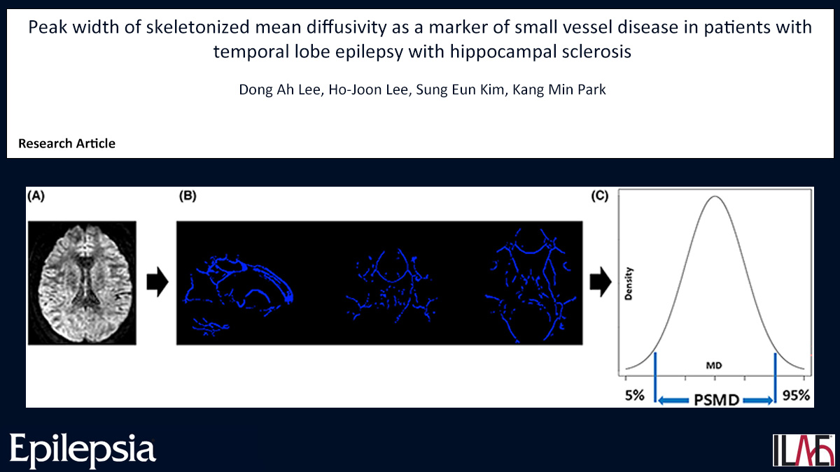 EpilepsiaJourn's tweet photo. Key point: PSMD is known to be a novel marker that reflects white matter damage probably due to SVD.
https://t.co/OE5iEqH1dB

#epilepsy #ILAE #cerebralsmallvesseldisease #diffusiontensorimaging #temporallobeepilepsy @IlaeWeb @WileyNeuro @epilepsiajourn https://t.co/bhRmVhgXoO