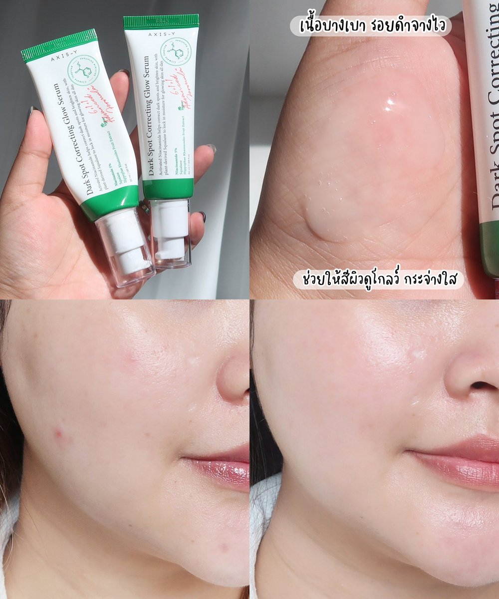 ใช้ AXIS-Y หมดไปหลอดนึงล่ะ ไม่เล่นเลยจริงๆ สมแล้วที่แมส รอยจางจึ้งมากกกกก ชอบที่มันช่วยแก้ปัญหาผิวแบบครอบคลุมอ่ะ รอยสิวรอยดำ ฝ้ากระใดๆจางลงหมดเลย หน้าใสขึ้น ผิวโกลว์ขึ้นแล้วสิวใหม่ไม่มาเลย https://t.co/cc8nWudnyY