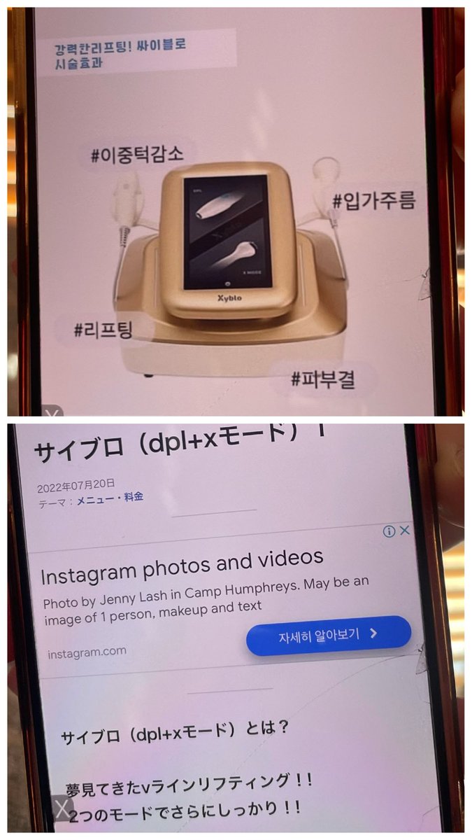 マイセルクリニック　📍新沙①

ダイエット薬💊脂肪溶解、タイトニングに強く韓国人からの評判が良いと聞いて行ってきた！感動👀良すぎたー！

⭐️室長さんの的確な診断が凄い！
⭐️院長、スタッフさん丁寧！
⭐️リフト系、手術の選択肢多い
⭐️院内綺麗、雰囲気好き！