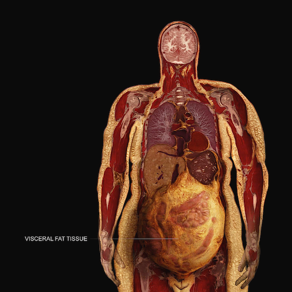 The most dangerous fat in your body:

Visceral fat.

This "hidden fat" is silently destroying your health &amp; most people don’t even know they have it...

Here’s what it is, why it’s bad &amp; how to fix it: