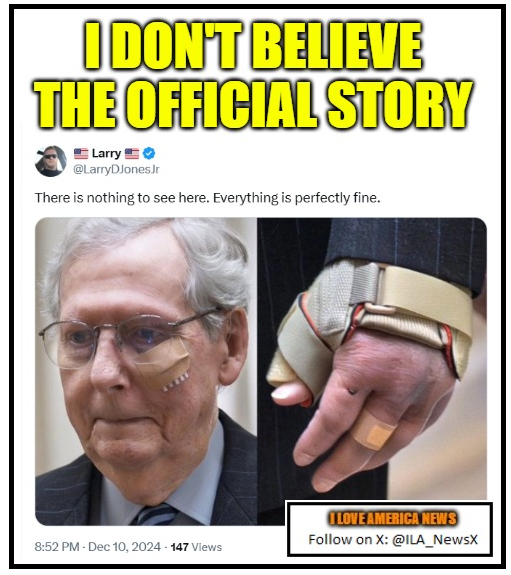 ILA_NewsX's tweet photo. As someone with scars on all my knuckles, I would bet good money that the injuries on that hand are the result of a conflict. #FakeNews #SwampTurtle
https://t.co/ypmXVwZYA1 https://t.co/xlKlw8EOs0
