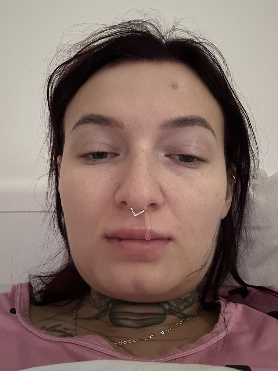 Momalovanka's tweet photo. Zdravá    X   Nemocná https://t.co/4QjdhB4mIf