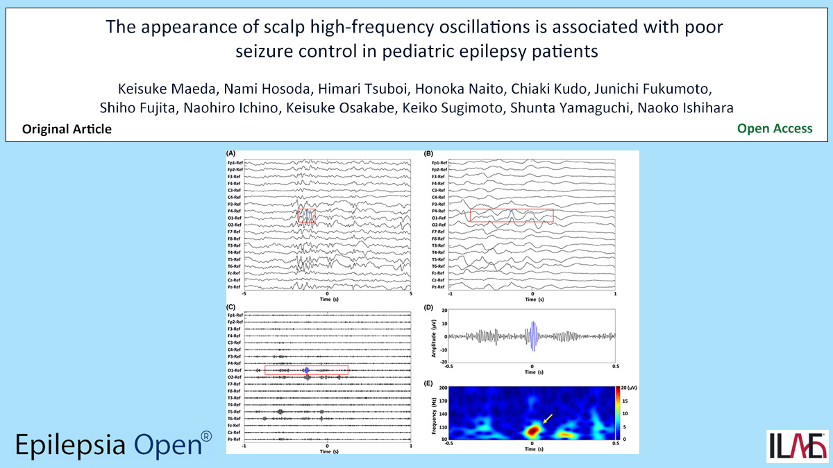 Epilepsia Open (@epilepsiaopen) on Twitter photo Key point: Scalp high-frequency oscillation (#HFO) was seen more commonly and with a significantly higher detection rate in patients with poor seizure control.
doi.org/10.1002/epi4.1…
#epilepsy #ILAE #ASM #pediatric #ripple #spike <a href="/IlaeWeb/">International League Against Epilepsy</a> <a href="/WileyNeuro/">Wiley Neuro</a> @Epilepsiaopen Key point: Scalp high-frequency oscillation (#HFO) was seen more commonly and with a significantly higher detection rate in patients with poor seizure control.
doi.org/10.1002/epi4.1…
#epilepsy #ILAE #ASM #pediatric #ripple #spike <a href="/IlaeWeb/">International League Against Epilepsy</a> <a href="/WileyNeuro/">Wiley Neuro</a> @Epilepsiaopen