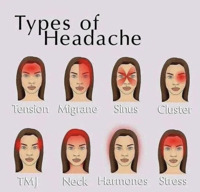 LearnThinx's tweet image. Types of Headaches