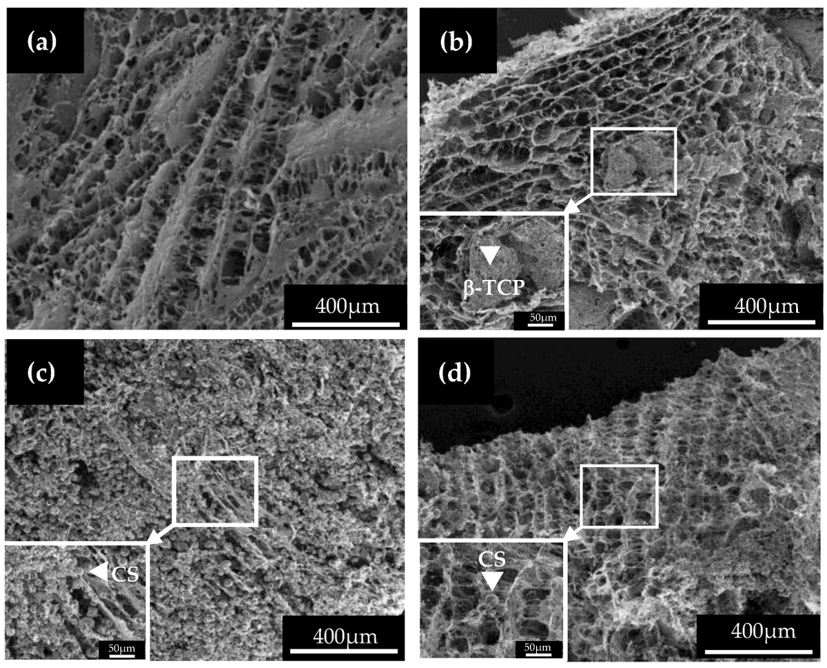 Ceramics_MDPI's tweet image. Effect of Calcium #Silicate and β-Tricalcium Phosphate Reinforcement on the Mechanical–Biological Properties of Freeze-Dried #Collagen #Composite #Scaffolds for Bone #Tissue #Engineering Applications

Ceramics 2023, 6(1), 548-560; mdpi.com/2571-6131/6/1/…
