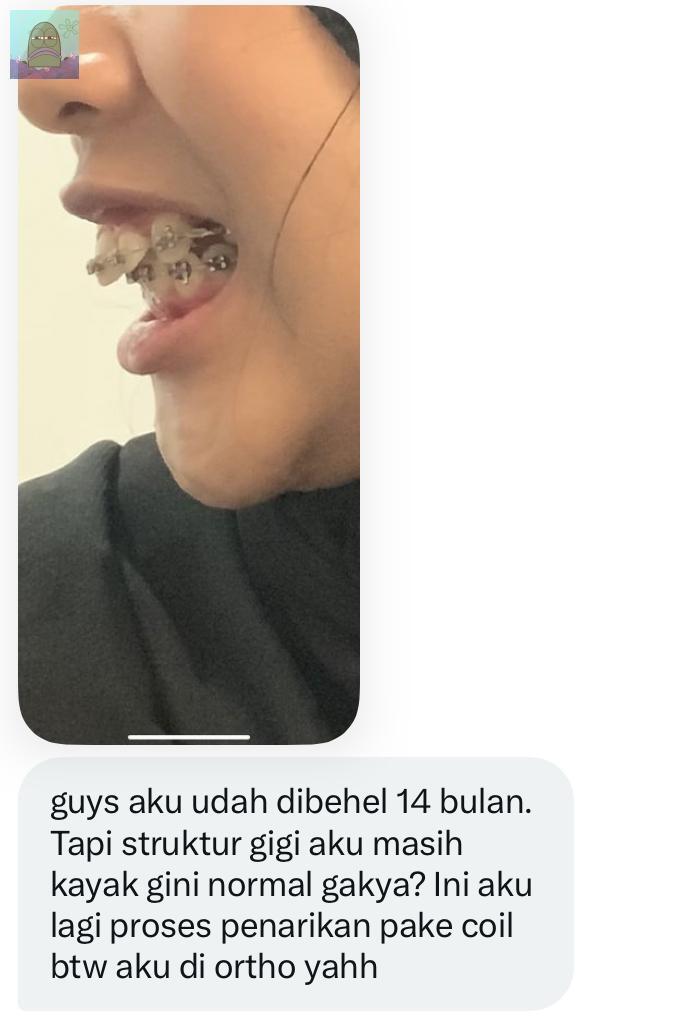 Tanyarl 💚 tweet media