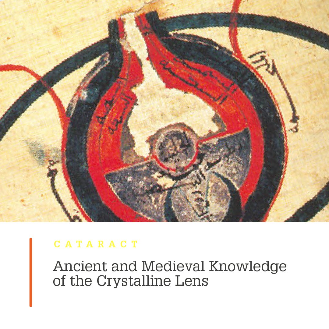 OphthoMag's tweet photo. The Ophthalmologist’s Time Machine team debunk a long-standing myth about ancient and medieval knowledge of the crystalline lens #eyehistory #medicalhistory
https://t.co/WAQzqCeHDV https://t.co/8wkS3aE22o