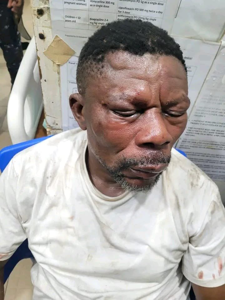 KevinEkowTaylor's tweet photo. This is what Afenyo Marlin has done to the NDC Vice  chairman in Effutu Senya this callls for retaliation. NOBODY GO SLEEP FROM TODAY https://t.co/1vfKQmxasK