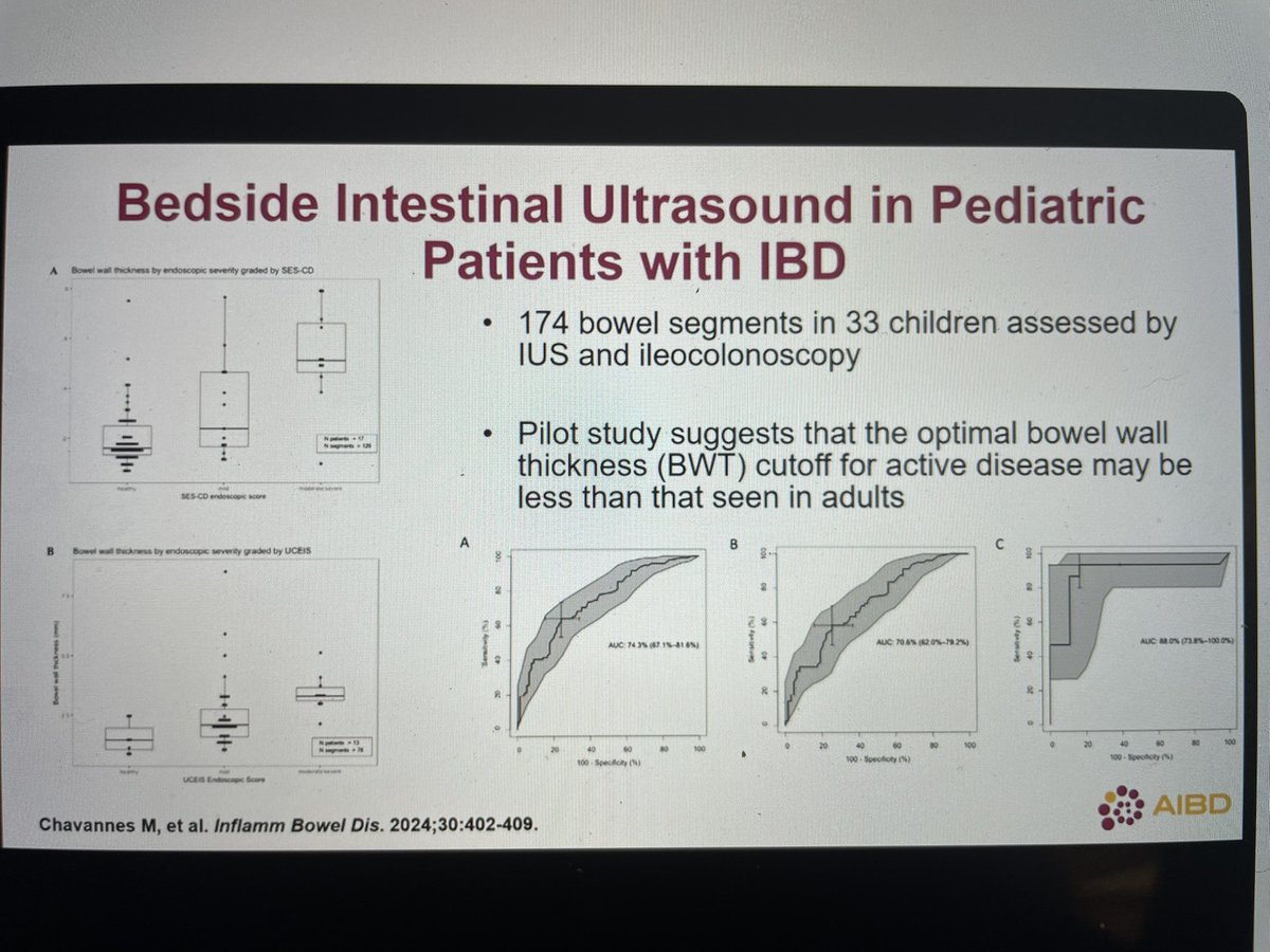 Optimal cut-off for BWT on IUS is lower in pediatric patients with IBD-more to come soon! <a href="/malloc_doc/">Mallory Chavannes, MD, MHSc</a> #AIBD2024 <a href="/IBDConference/">@IBDConference</a>