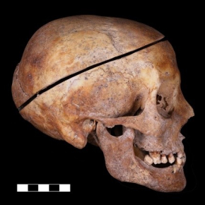 CNRS Aquitaine (@cnrsaquitaine) on Twitter photo Découverte d’une pratique familiale d’embaumement des corps dans le Sud-Ouest de la France au début de l’Époque moderne.
<a href="/CNRS/">CNRS 🌍</a> <a href="/PACEA_Bordeaux/">PACEA</a> <a href="/univbordeaux/">Université de Bordeaux</a> <a href="/CNRSshs/">CNRS Sciences humaines & sociales</a>
➡️inee.cnrs.fr/fr/cnrsinfo/de… Découverte d’une pratique familiale d’embaumement des corps dans le Sud-Ouest de la France au début de l’Époque moderne.
<a href="/CNRS/">CNRS 🌍</a> <a href="/PACEA_Bordeaux/">PACEA</a> <a href="/univbordeaux/">Université de Bordeaux</a> <a href="/CNRSshs/">CNRS Sciences humaines & sociales</a>
➡️inee.cnrs.fr/fr/cnrsinfo/de…