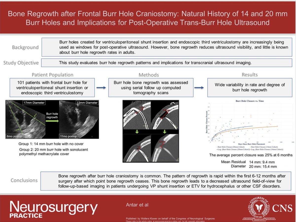 NeurosurgeryCNS's tweet image. #NEUPracVisualAbstract Bone Regrowth After Frontal Burr Hole Craniostomy: Natural History of 14-mm and 20-mm Burr Holes and Implications for Postoperative Trans-Burr Hole Ultrasound bit.ly/4ix0v16 Antar et al @HopkinsMedicine @CNS_Update @DKondziolkaCNS