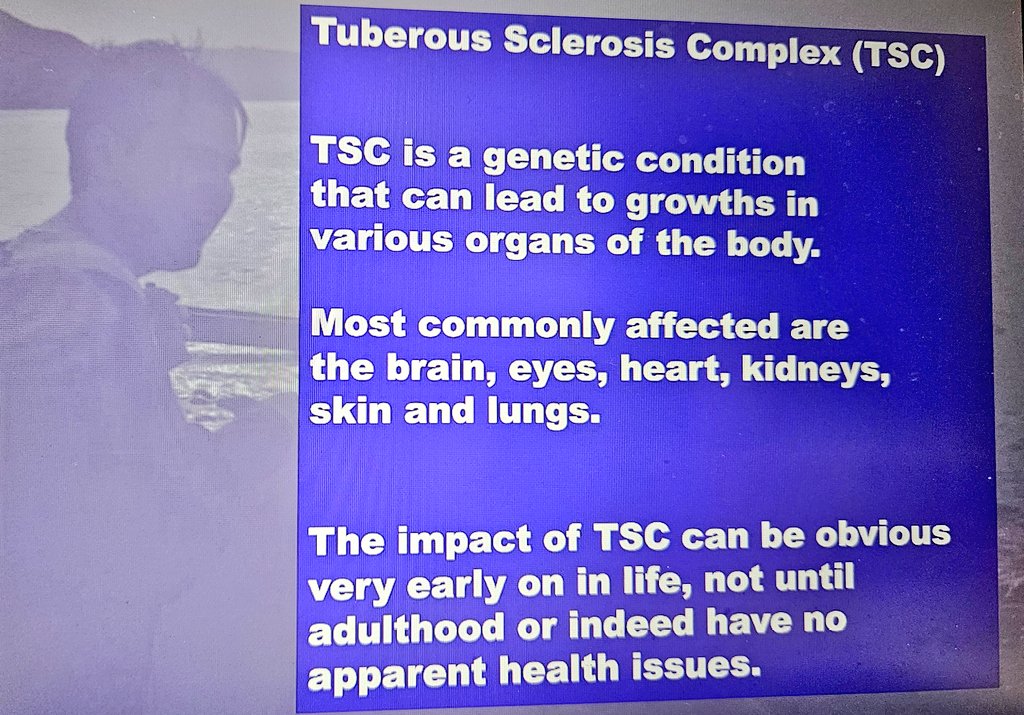 WalesGenePark's tweet photo. Delighted to be holding a Living With Genetic Conditions session with @CardiffMetCSHS students. Huge thanks to our amazing expert Consultant Geneticist Dr Annie Procter &amp; #RareDisease Advocate @PMTJames sharing her family's experiences of tuberous sclerosis @GeneticAll_UK @UKTSA https://t.co/Esayee8WQF
