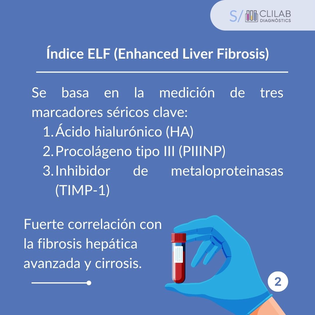 🎯 ¿Sabías que el 40% de los pacientes con #MASDL pueden desarrollar fibrosis avanzada? Detectarla a tiempo con biomarcadores como el ELF es clave para evitar la cirrosis. ¡Descubre más en nuestro nuevo blog! clilab.cat/es/marcadores-… 📈 #SaludHepática #FibrosisHepática