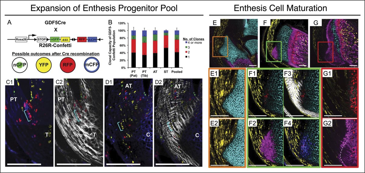OfficialJAAOS's tweet photo. New findings on: Leveraging insights from development to improve adult repair: hedgehog signaling as a master regulator of enthesis fibrocartilage formation are changing the game! @DymentLabPenn 

Read HERE: https://t.co/IdEBbmCkKc https://t.co/iQ7gOgm3TX