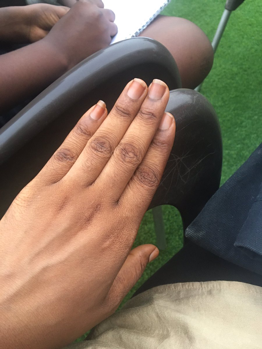 Queenjilo66's tweet photo. @iam_immalove Na ring remain😂 https://t.co/h1GimVMIXD