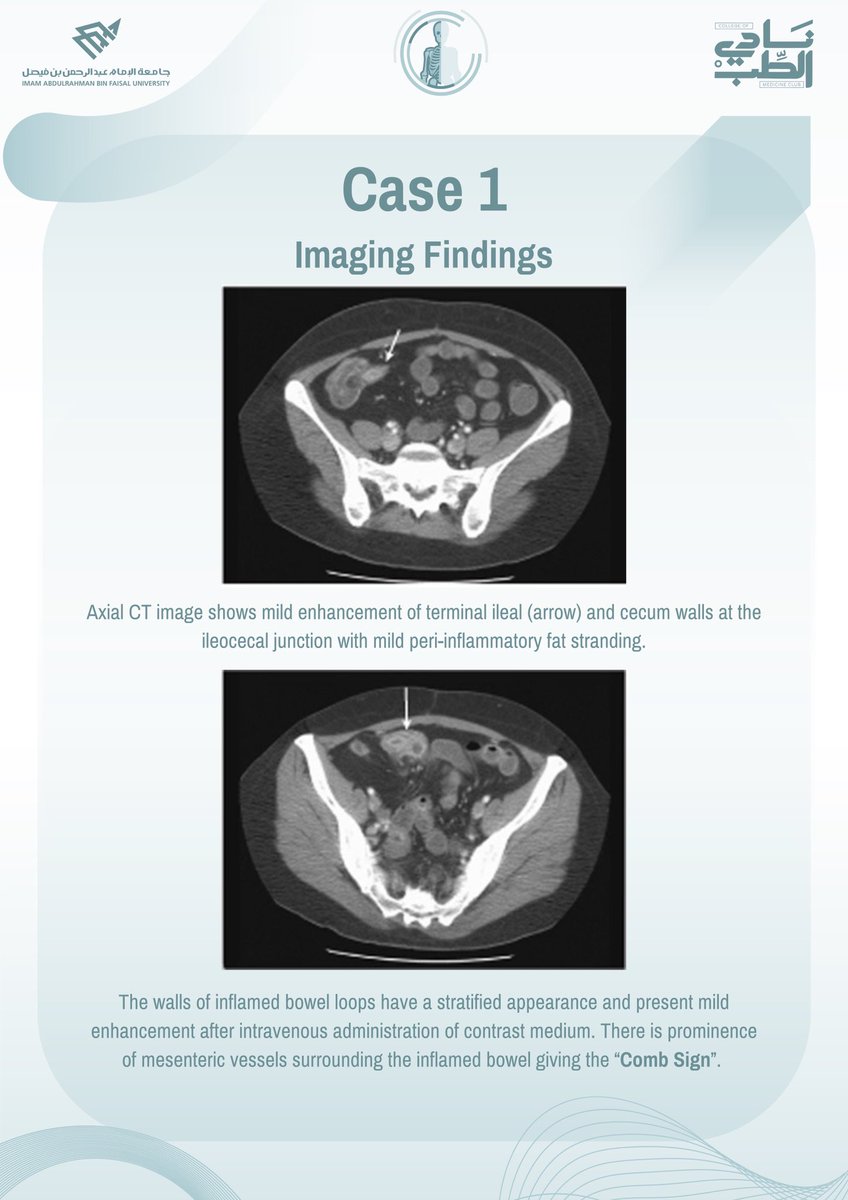RadClubIAU's tweet photo. Ready for a diagnostic challenge? π
Share your thoughts belowππ»
#RadClubIAU #Abdomen https://t.co/NM2uICcvqF