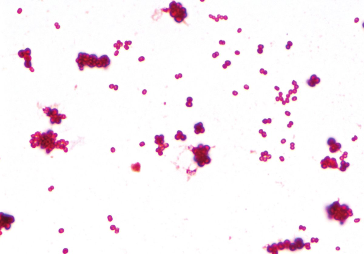 New in <a href="/ASMCaseReports/">ASMCaseReports</a> | Dr. Thamer Alaifan and colleagues present a case of severe chest wall necrotizing soft tissue infection caused by two rare organisms. <a href="/ARazak_97/">عبدالرزاق</a> <a href="/AlaifanT/">Thamer Alaifan</a> <a href="/ASMicrobiology/">ASM</a> 

Examine the case: doi.org/10.1128/asmcr.…