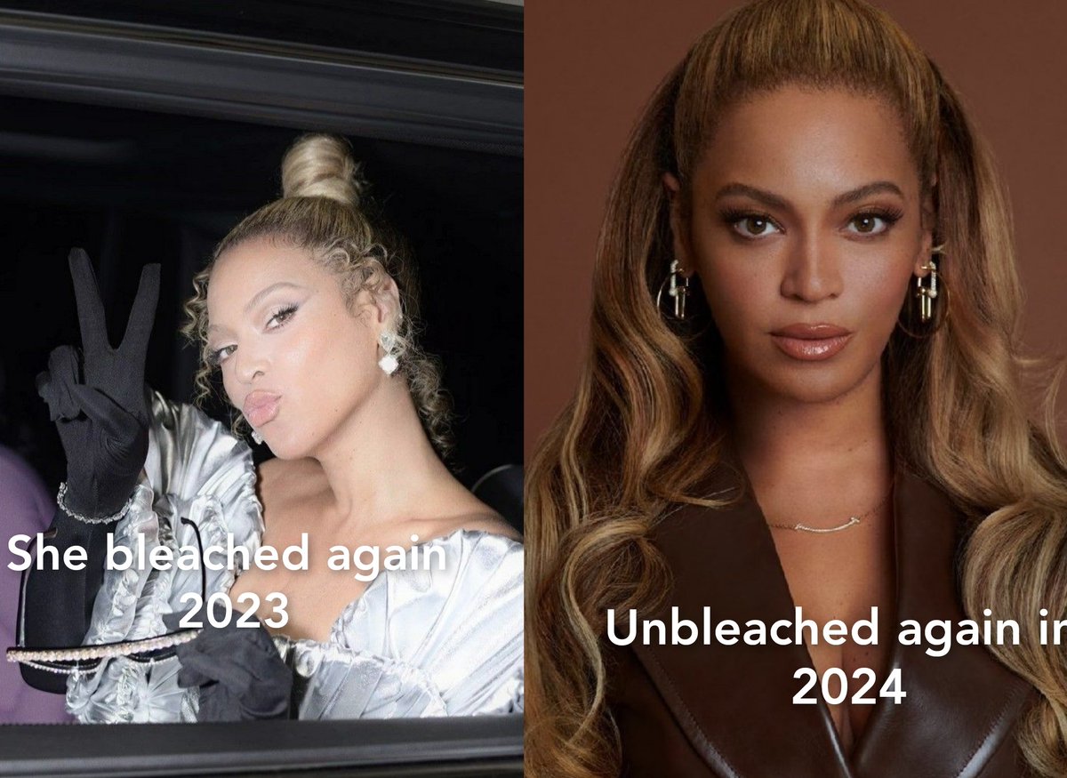 Only Beyoncé can bleach and unbleach whenever she wants too. 
🤡🤡🤡🤡
