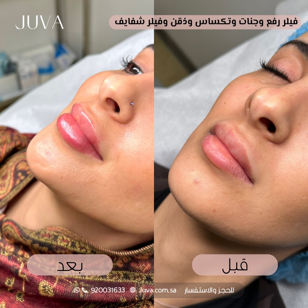 عيادات جوفا | Juva Clinic tweet media