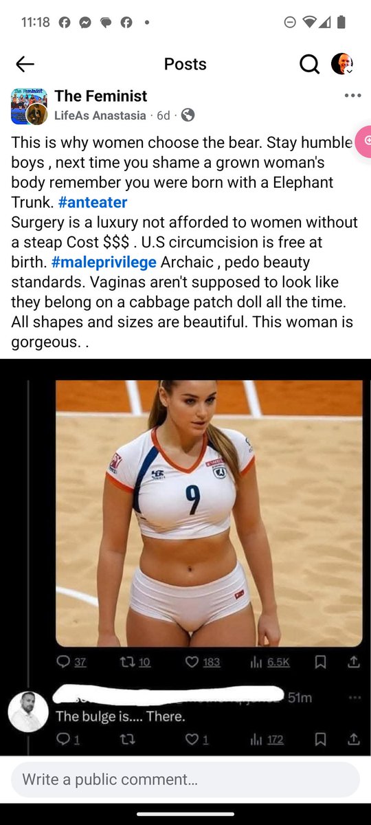 adkisojk's tweet photo. Shouldn't be body shaming men either. Stop using terms that do. I wish I still had my prepuce, I don't consider "Circumcision" (a euphemistic term) to be #maleprivilege. I have two adult sons who are intact and I would like the society that they live in to consider them lucky instead of yucky.