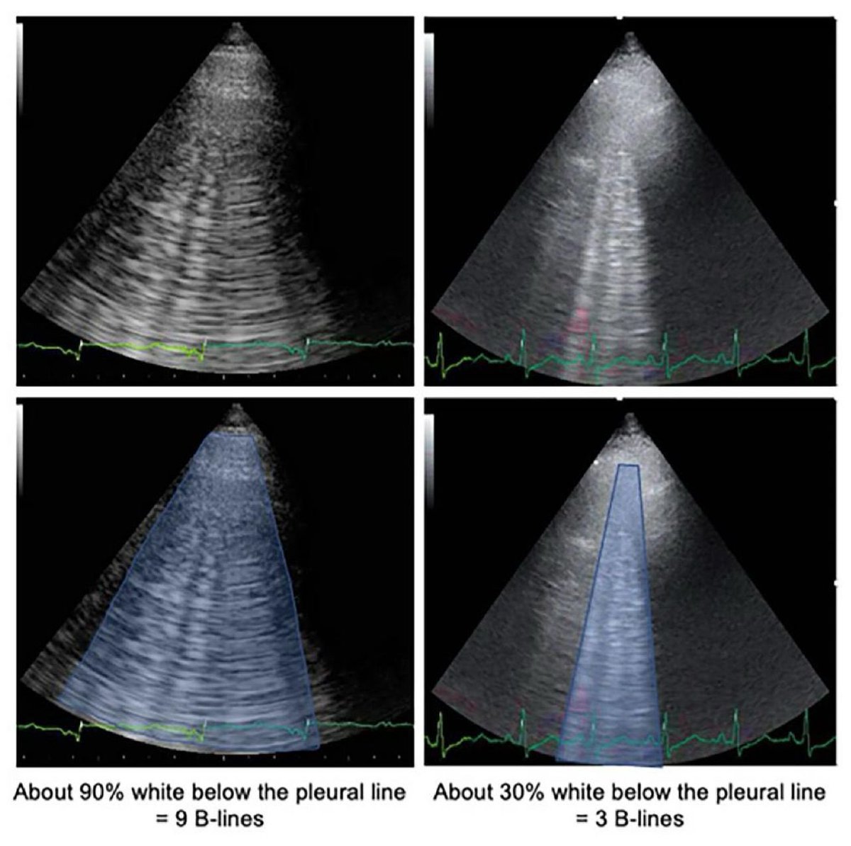 POCUSmedicine tweet media