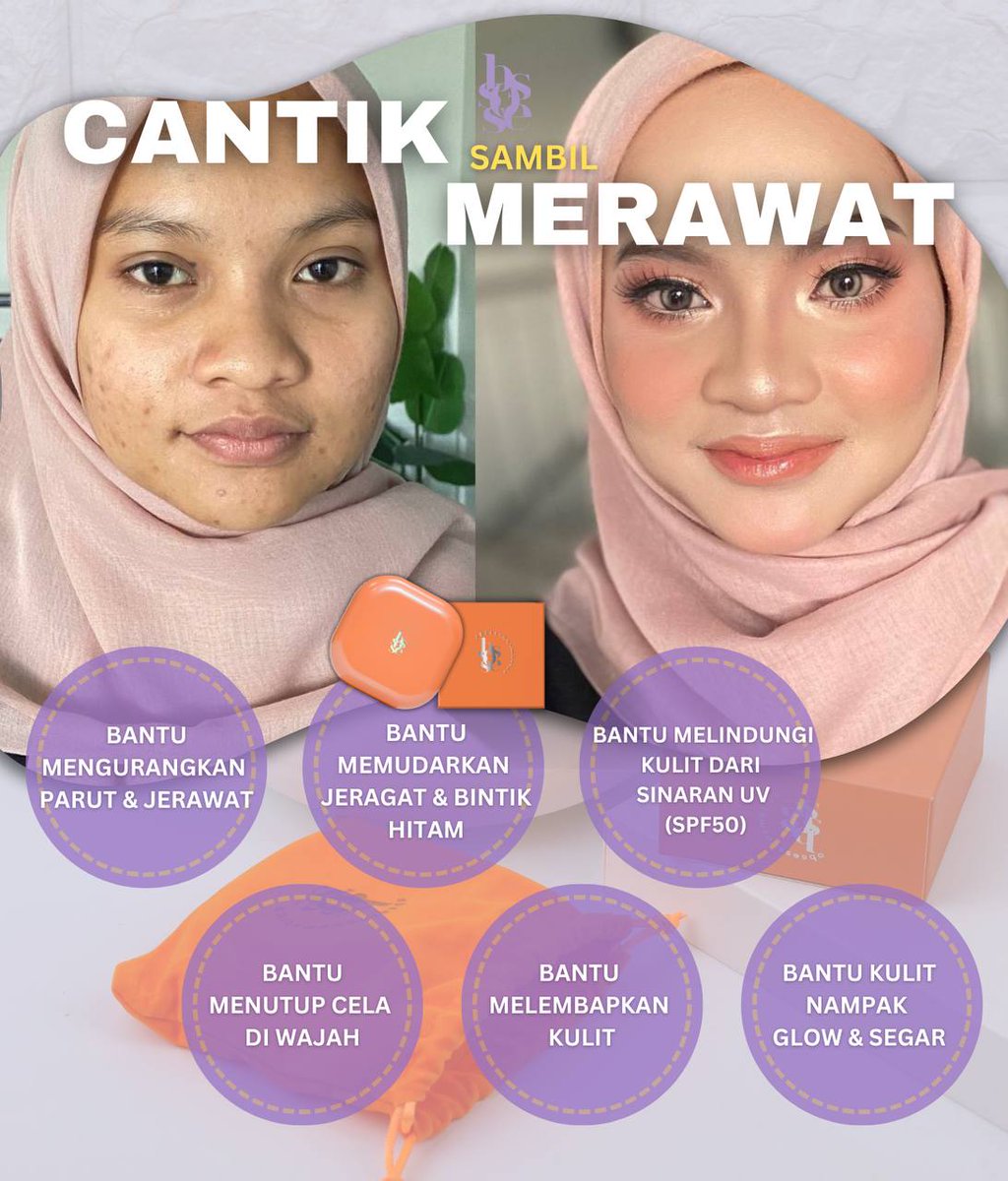 Foundation ni bukan setakat cover parut jerawat, tapi rawat kulit sekali! Treatment Cushion Foundation ni ringan, ada SPF 50, dan dewy finish. Konfem nampak natural je tauu. 

Sekarang sales harga tak sampai RM50 pun
hi.jomwasap.my/Bywanyy